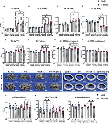 The osteocytic actions of glucocorticoids on bone mass, mechanical properties, or perilacunar remodeling outcomes are not rescued by PTH(1-34)